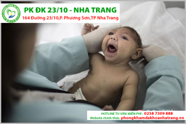 Thai dị tật ảnh hưởng lớn đến cuộc sống của bé