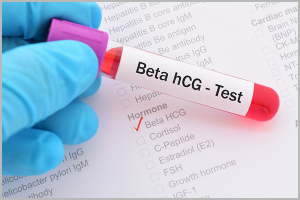 NHỮNG THÔNG TIN CẦN BIẾT VỀ XÉT NGHIỆM HCG